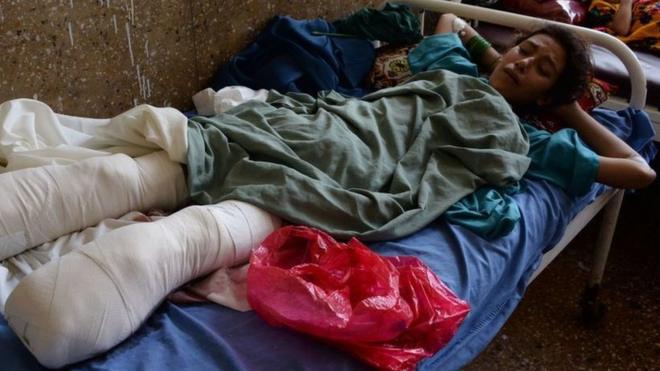 Wounded Afghan girl