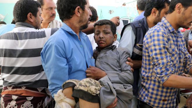 Раненый йеменский мальчик, Сана (9 августа 2018)