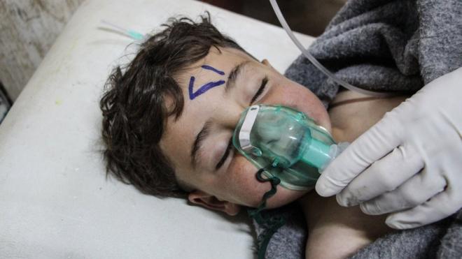 Ребенок в больнице после химической атаки в Хан-Шенхуне в 2017 году