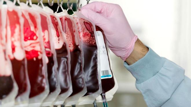 Переливания крови молодых доноров могут замедлять старение