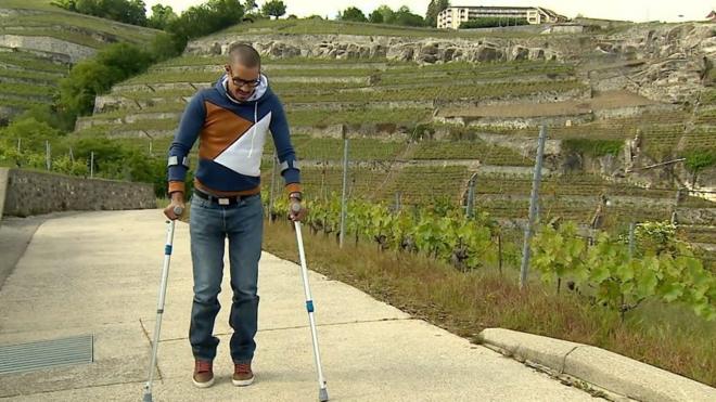 7 лет назад Дэвид перестал ходить из-за спортивной травмы, теперь при помощи импланта он может пройти до 1 км.