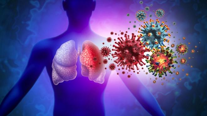 Triple Virus Lung Infection and Tripledemic Human lung infection and respiratory inflammation disease as influenza flu outbreak or pneumonia and pulmonary inflammatory illness with 3D illustration elements.