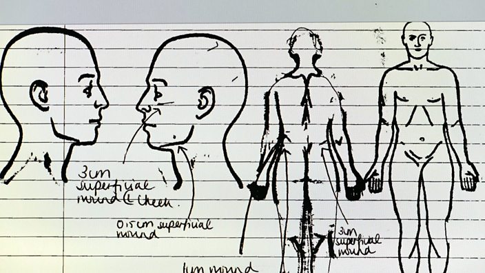 Medical drawings show Aodh's i...