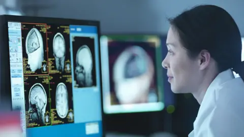 Doctor looking at MRI scans on a screen