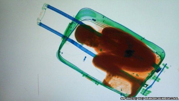A picture provided by Spanish Guardia Civil on May 8, 2015 shows an X-ray image showing an 8-year-old sub-Saharan boy hidden in a suitcase.
