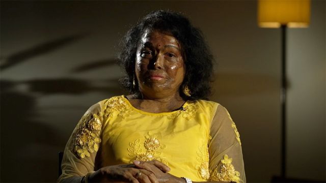 Женщина в желтом сари с обгоревшим лицом
