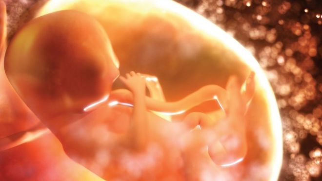 Foetus image