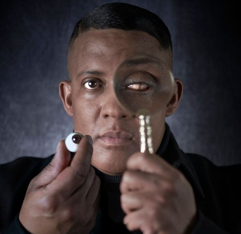 A man holds a false eye in on hand and holds a magnifying glass up to the empty socket