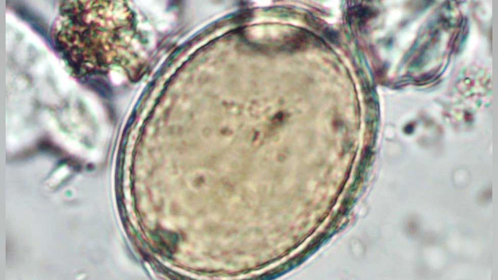Roundworm egg from medieval friar