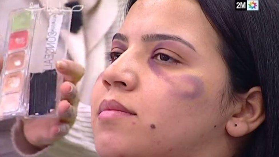 The show Sabahiyat, broadcast on Morocco TV channel 2M, advises women how to hide bruising with make-up