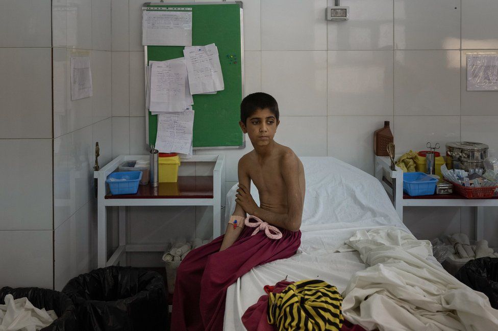 Imran sits in a hospital in Lashkar Gah, where the boys were examined in October. Image: Julian Busch/BBC