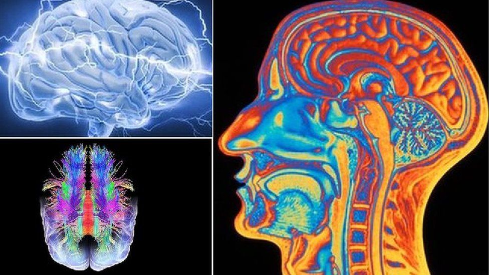 Various scientific images of brains