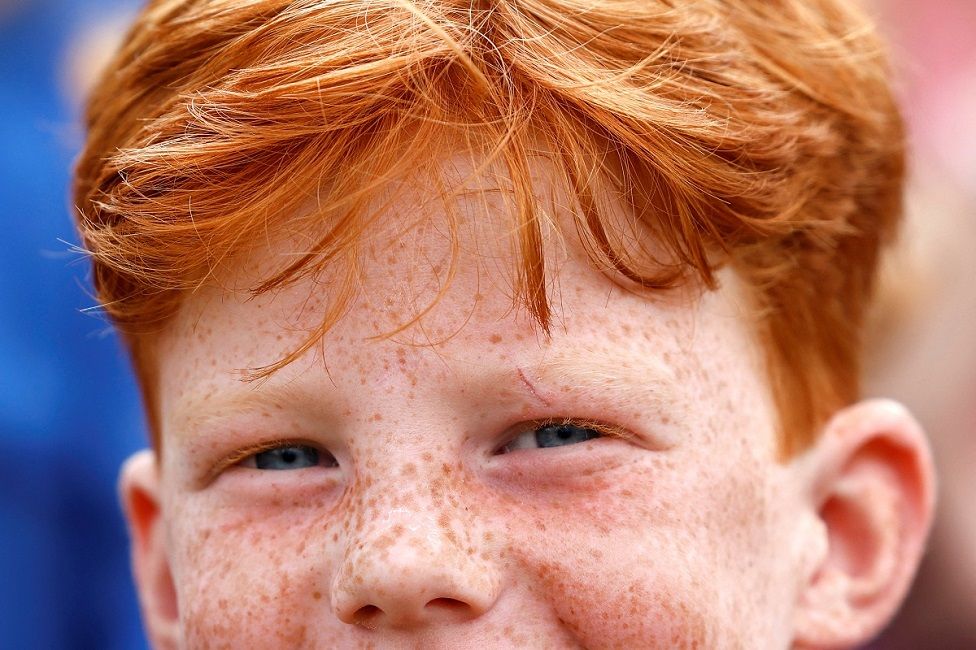 A child with freckles and blue eyes stares into the camera