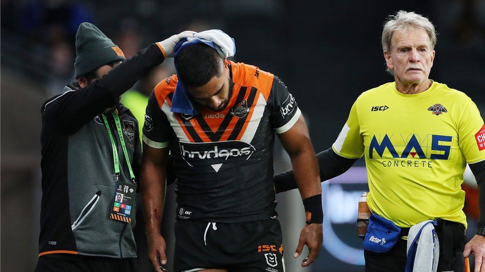 Rugby player leaves the field for a head injury assessment