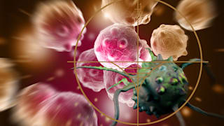 Krebs: Über Arten, Symptome, Diagnose und Behandlung 