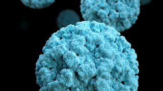 Norovirus: Symptome, Behandlung, Diagnose, Ansteckungsgefahr