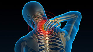Nackenschmerzen lösen: Behandlung und Ursache