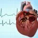 Atrial Fibrillation: Heart Symptoms, Diagnosis, & AFib Treatment