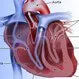 Heart Disease: Symptoms, Signs, and Causes