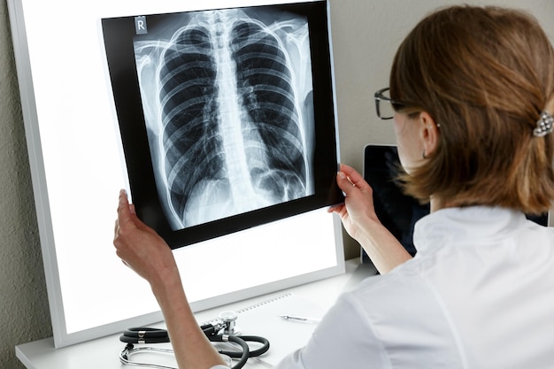 Pulmonologist therapist examining an xray of lungs