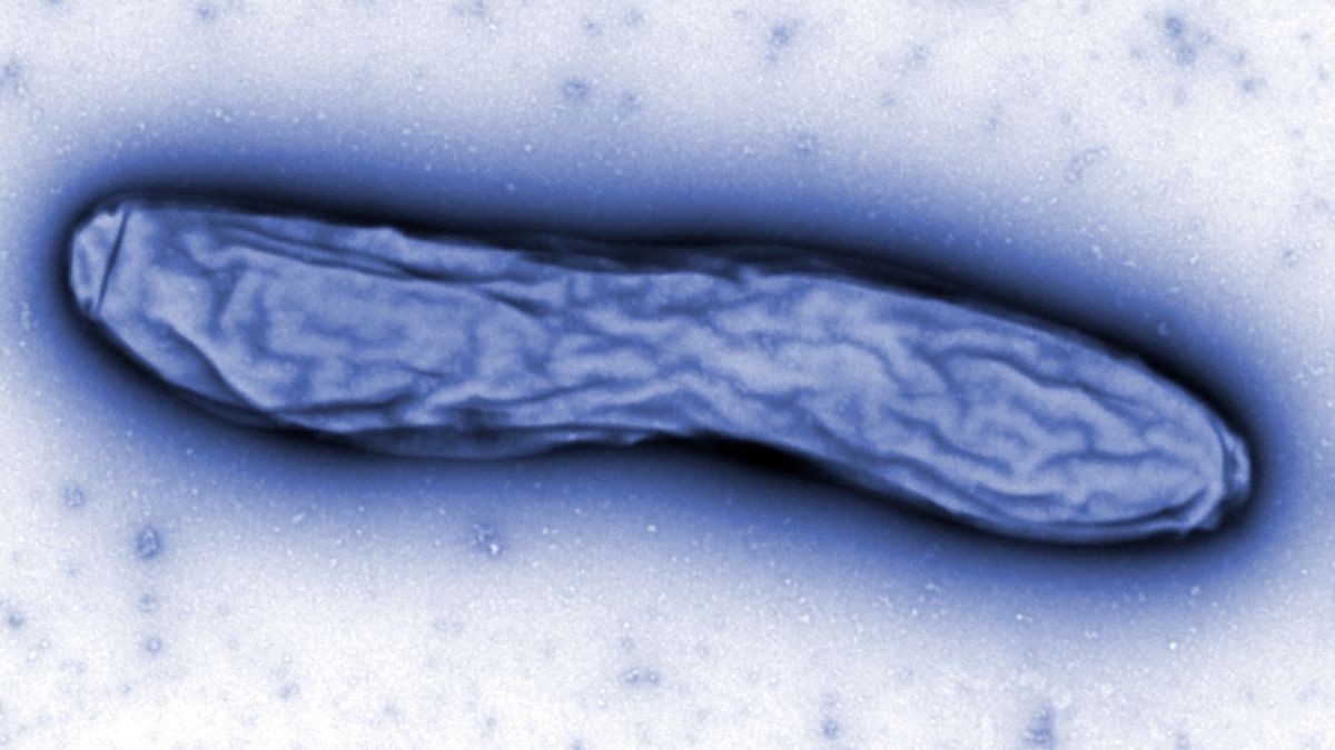 Eine elektronenmikroskopische Aufnahme des Bakteriums der Gattung Legionella/Legionellen.