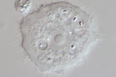 Патогенная свободноживущая амеба под световым микроскопом. Фото: Wikimedia Commons