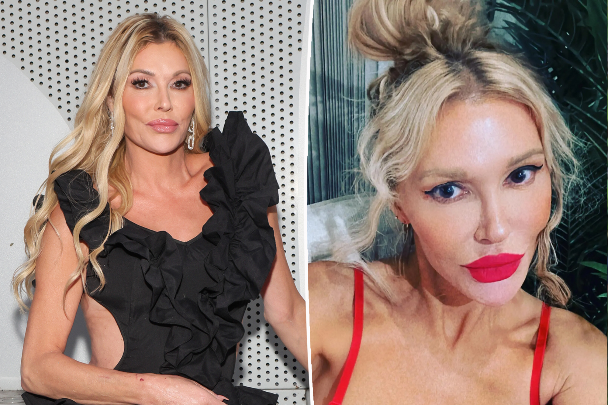 Brandi Glanville reveals favorite cosmetic procedures and regrets over ‘crazy’ cheek filler: ‘It was nuts’