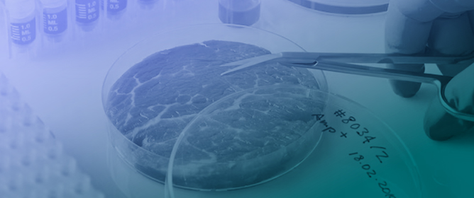 Genome-Wide Association (GWAS) Applied to Carcass and Meat Traits of Nellore Cattle