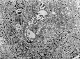Участок ткани, инфицированный Rift Valley fever phlebovirus