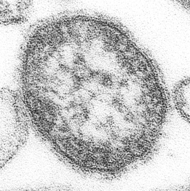 Measles virus.JPG