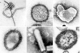Микрофотографии некоторых вирусов из типа Negarnaviricota, полученные с помощью просвечивающего электронного микроскопа. Не в масштабе. Слева направо, сверху вниз: эболавирус Заир, вирус Син Номбре, респираторно-синцитиальный вирус человека, вирус Хендра, неидентифицированные рабдовирусы, вирус кори