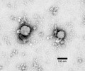 Lymphocytic choriomeningitis virus (Arenaviridae)