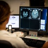 Article thumbnail: 77-year-old patient with signs of stroke is treated. Following the MRI, the neurologist hesitates on the procedure to follow and consults his colleague. (Photo by: BSIP/Education Images/Universal Images Group via Getty Images)