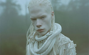 My Photo Series “Porcelain Beauty”, Showcasing People With Albinism, Continues With The Help Of AI (15 Pics)