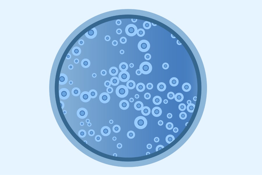 Medical illustration of <em>C. neoformans</em>.