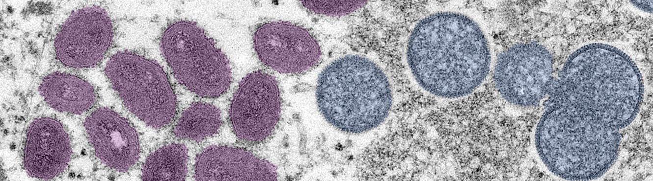A microscopic image of the Monkeypox virus