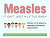 infographic: Measles: It isn't just a little rash