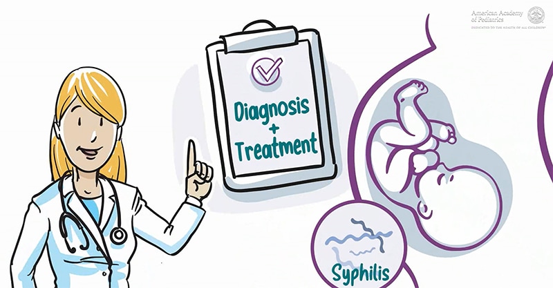 Congenital Syphilis Diagnosed Beyond the Neonatal Period in the United States: 2014-2018