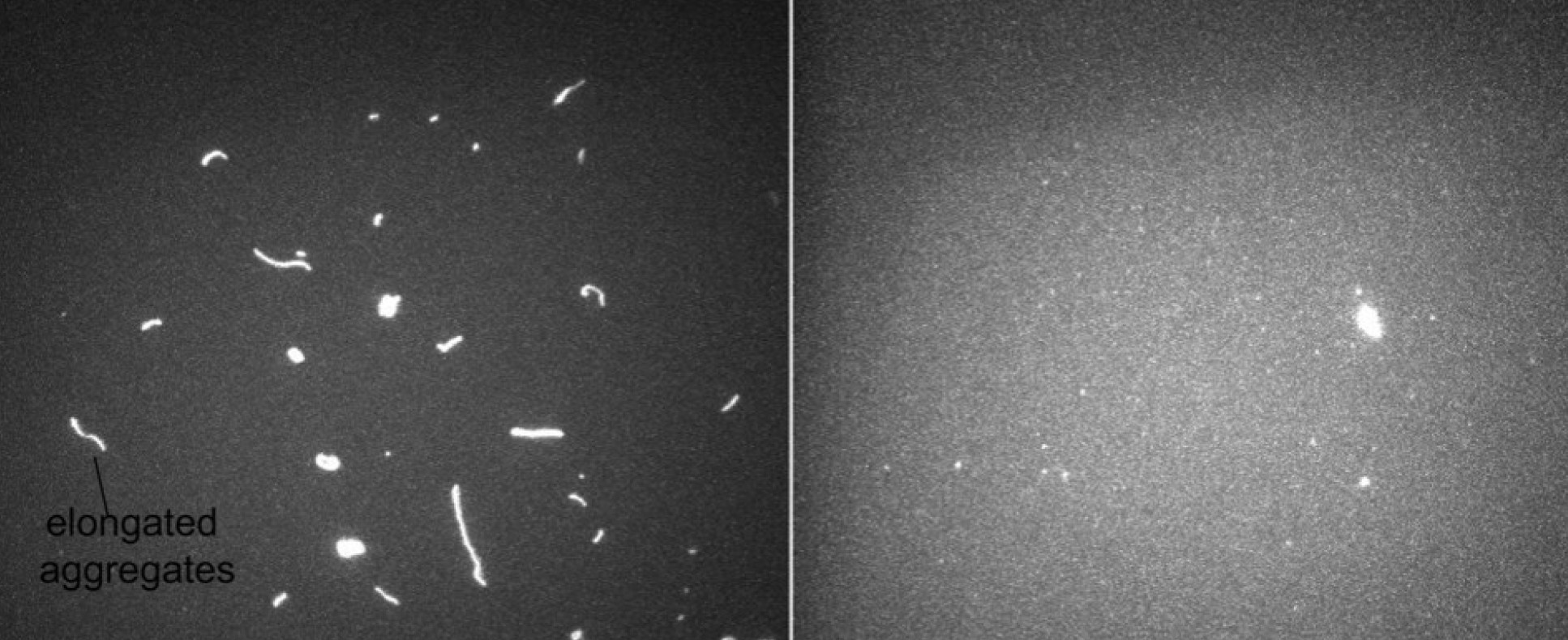 Black and white microscope image of Tau