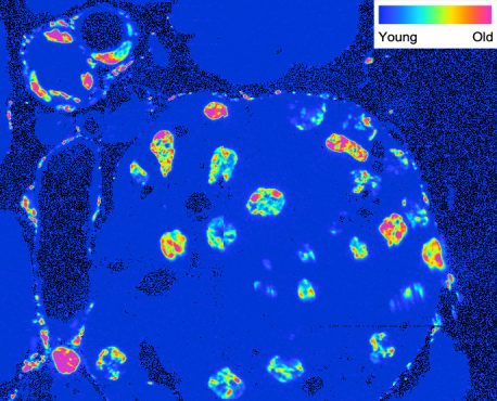 Isotope imaging of different cells inside an islet of Langerhans within the pancreas. Older cells have a yellow-to-pink color scheme, while younger cells exhibit a blue-to-green color pattern.