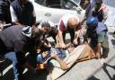 Injured journalists from TRT Arabic channeI are brought to Avde hospital for medical treatment after an Israeli attack at the Nuseirat Refugee Camp in Deir Al Balah, Gaza on April 12, 2024