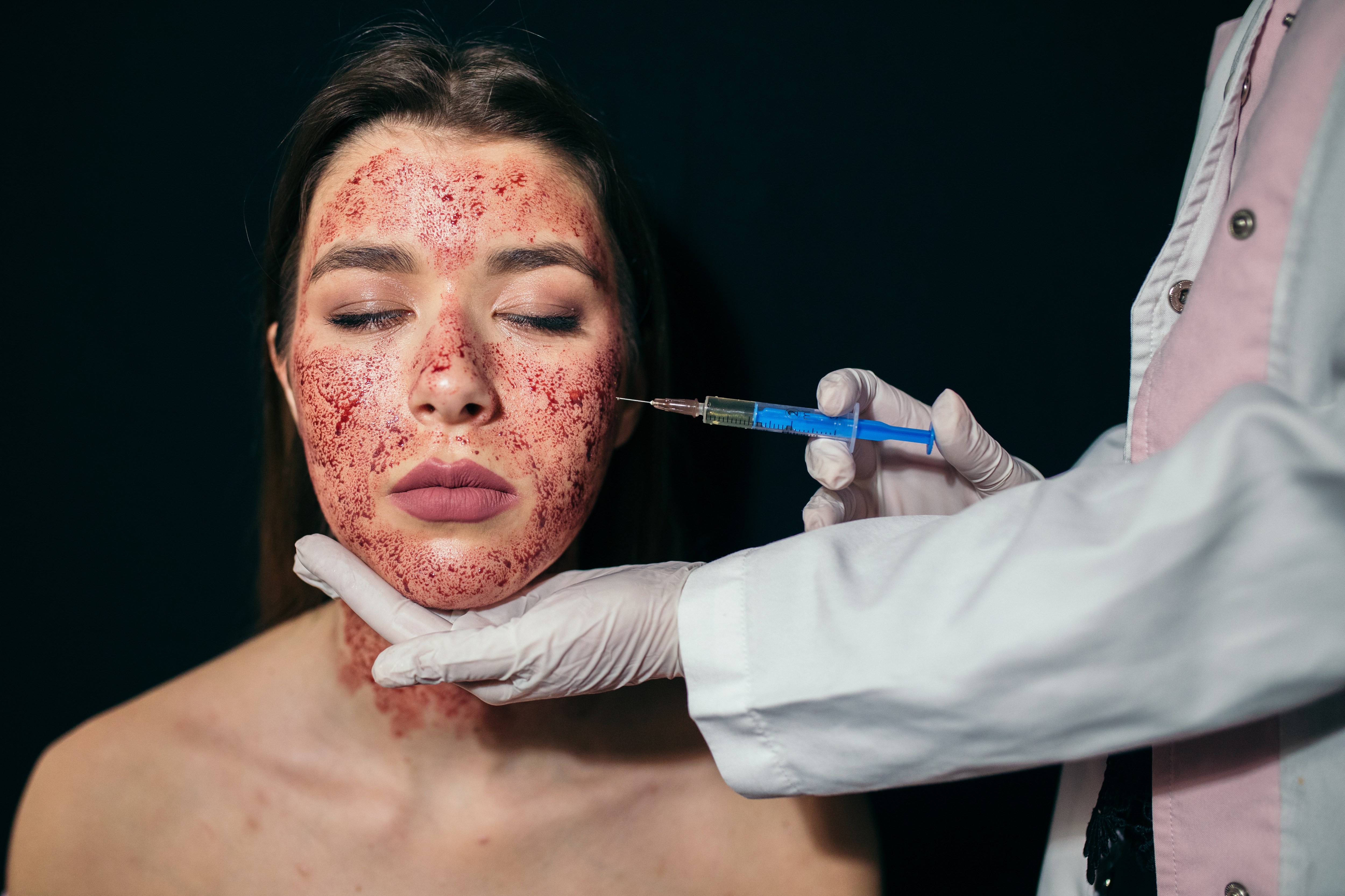 Three women infected with HIV after having ‘vampire facials’