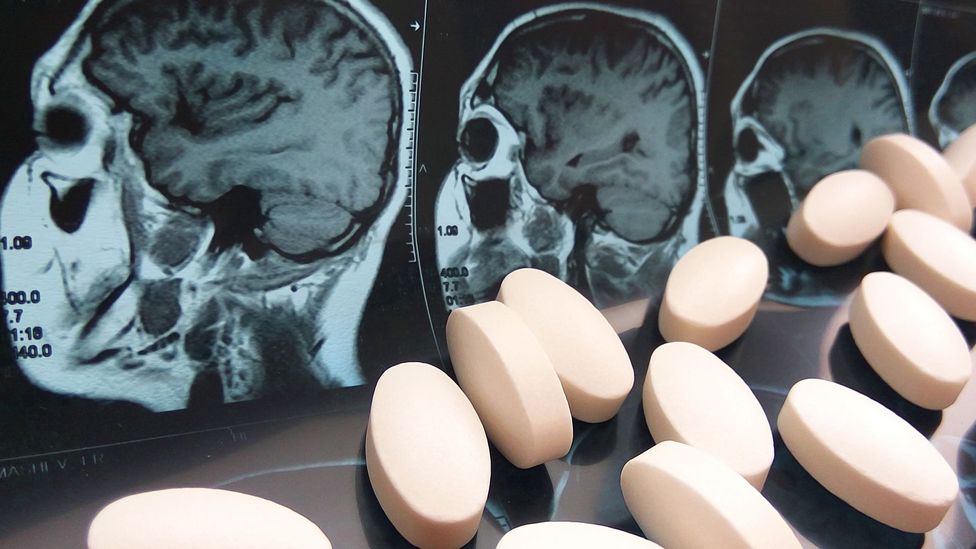 Pills and brain x-ray (Credit: Getty Images)