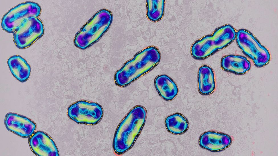 Yersinia pestis bacteria through a microscope (Credit: Getty Images)